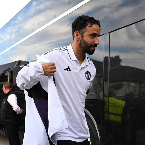 team-news-for-burnley-encounter team-news-for-burnley-encounter